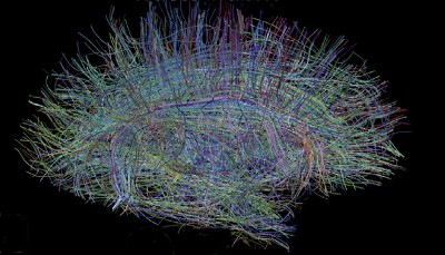 Brainbow from the National Institute of Mental Health